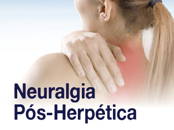 neuralgia-her
